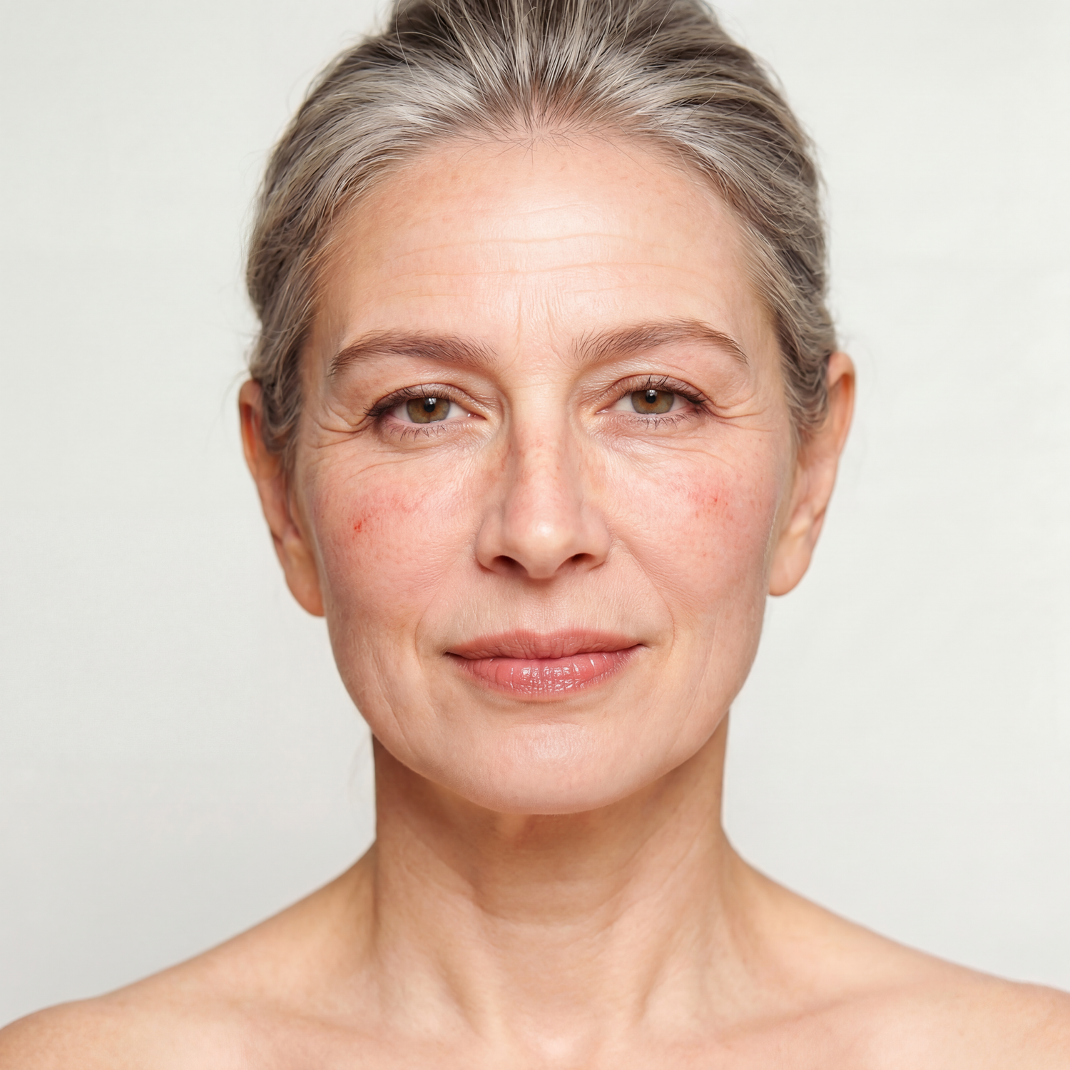 Rosacea-Prone Skin? How Botanical Ingredients Finally Calm Redness and Irritation for Good